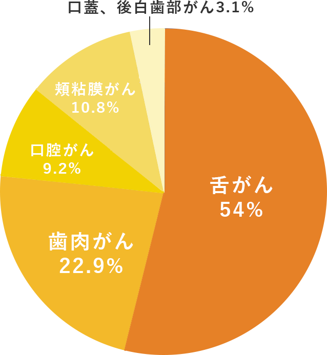 口腔がんになりやすいタイプとは